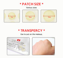 Load image into Gallery viewer, Acne Pimple Master 24 patches